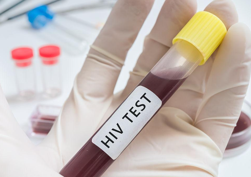 2025年HIV患者可以做试管生宝宝，选对技术不可怕！