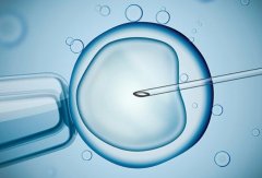 解读取卵后腹水与移植时间的关系：科学规划生育计划