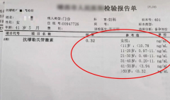 AMH对女性备孕有如此重要的意义，难怪要检查它！