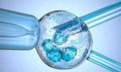试管腹水是怎么回事？快来了解原因、影响和治疗方法！