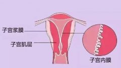子宫畸形：生育路上的障碍还是可逾越的坎？