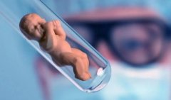 宫腹腔镜术后该注意啥？多久后能准备怀孕？