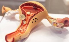 宫颈癌切除后，试管之路还畅通吗？检查方法及助孕成功率全解析！