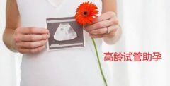 高龄产妇怀孕要做哪些检查？孕期守护指南来啦！