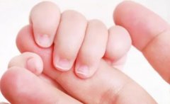 幼儿急疹出疹后护理攻略来啦！避开四大误区，效果杠杠的！