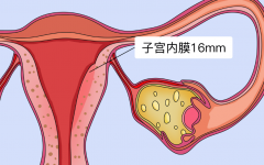 带你认识子宫内膜增厚，不孕症患者一定要了解！