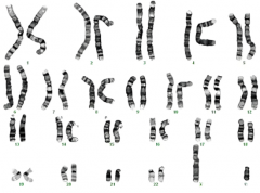 高龄怀孕过程多次胎停却不明原因,如何避免复发性胎停