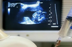 广东深圳第三代试管婴儿助孕生子机构推荐及排名