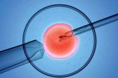 江西南昌第三代试管婴儿费用其实不贵，具体费用明细如下