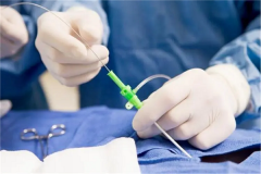 广西省单身人士选择百色市人民医院做试管成功率高不高？