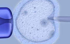 四川省做三代试管助孕一般需要多少钱？2026年试管移植全流程账单