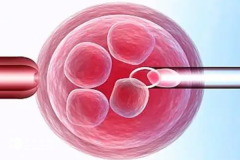 在云南省做三代试管婴儿助孕一般需要多少钱？
