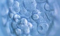 2026年单身去洛阳中心医院做试管婴儿全部费用大概多少？