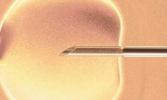 南宁市试管包成功服务可信吗？业内人士透露关键细节