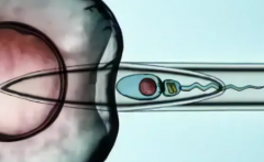 2026年哈尔滨市进行人工受孕费用多少？具体花费明细一览