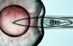 重庆三代试管助孕具体要多少费用？费用清单+避坑经验