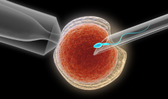 河北省三代试管婴儿费用明细 河北三代试管全流程价格一览