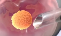 2026年成都市三代试管助孕费用及成功率价格表公示