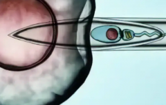 2026年单身女性在海南301医院做试管婴儿总费用是多少