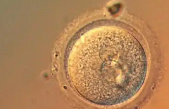 在海外做三代试管婴儿助孕生孩子需要多少钱？最新行情揭秘