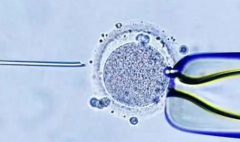 2026年贵州省三代试管费用大概8-15万左右，附详细费用清单和省钱方法