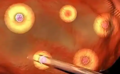 单身人士能在绵阳市妇幼保健院做第三代试管婴儿吗？成功率怎么样？