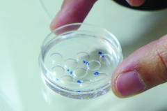 2026年在国内做试管助孕全程费用大概多少？详细费用清单曝光