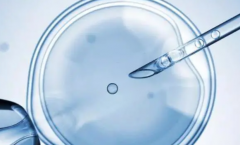 吉尔吉斯斯坦做第三代试管婴儿费用多少？具体包含哪些项目