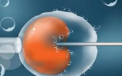 2026年中国三代试管婴儿包成功是真是假？流程步骤与注意要点