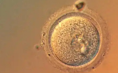 2026年无锡人民医院单身试管婴儿收费项目及价格一览表