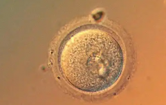 云南省昆明市试管婴儿包成功医院是不是骗人的？