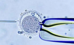 在海外第三代试管婴儿助孕，2026年价格参考及费用预估