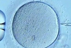 2026年单身去郑州大学第二附属医院做一次三代试管要花多少钱？费用详