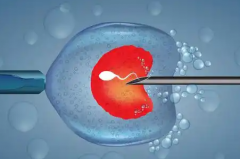 2026年浙江大学医学院附属第四医院单身人群试管婴儿费用明细价目表！