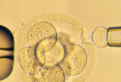 患者真实反馈：马来西亚试管包成功医院是否值得信任？