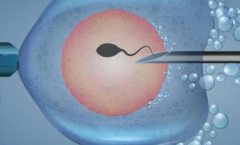 2026年未婚去江门市妇幼保健院做试管的总费用要多少？