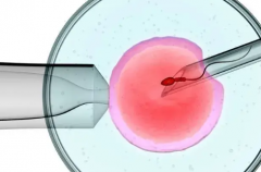 2026年武汉市三代试管包成功是真的吗？详细流程与注意事项分享