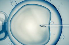 俄罗斯私人助孕机构提供的试管包成套餐可靠吗？