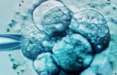 2026年格鲁吉亚三代试管婴儿包成功是真是假？流程步骤与注意要点