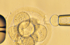 吉林省做三代试管费用明细？私立医院10-20万这样分配更精明