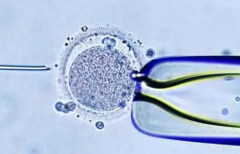 哪些人更推荐选择第三代试管婴儿包成功方案