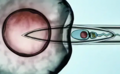 在吉尔吉斯斯坦第三代试管婴儿助孕，2026年价格参考及费用预估