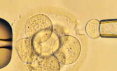 广东深圳市做三代试管费用明细？私立医院10-20万这样分配更精明