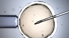 2026年马来西亚进行人工受孕费用多少？具体花费明细一览